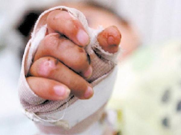 Navidad sin Pólvora en Bogotá: preocupa la subida de lesionados y víctimas | Regiones | Economía