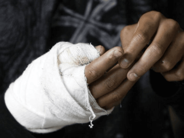 Balance de quemados con pólvora en diciembre 2024 | Regiones | Economía