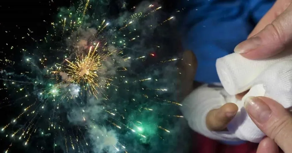 Más de 1.100 quemados con pólvora registrados en el país