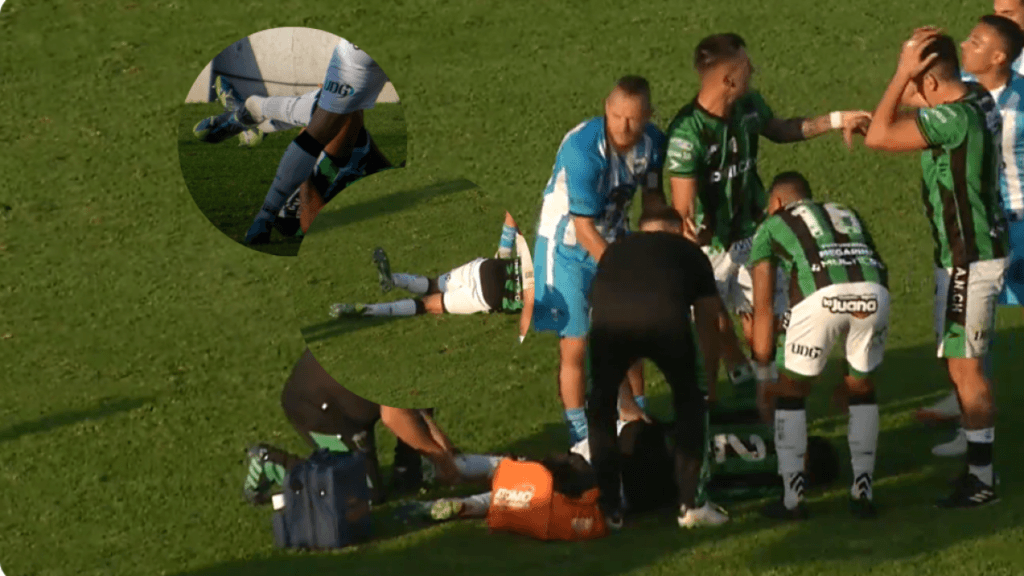Escalofriante lesión de Stefano Callegar, capitán de Nueva Chicago en Argentina: imágenes sensibles
