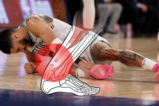 El informe Aquiles: las roturas del tendón son la nueva epidemia del deporte